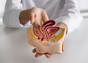 Cancerul Colorectal