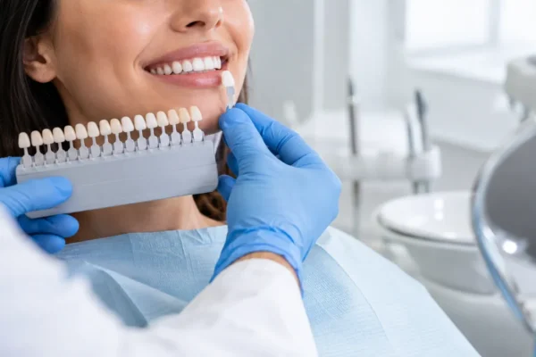 fatete-dentare-in-bucuresti-corectarea-rapida-a-esteticii-dentare